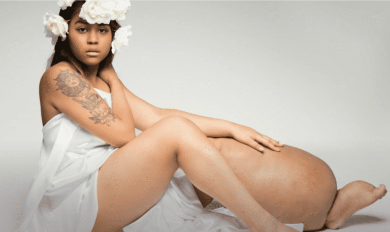 Beautiful Woman With Huge Leg Determined to Live Her Life (video)