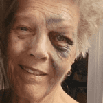 GoFundMe photo of beaten grandmother